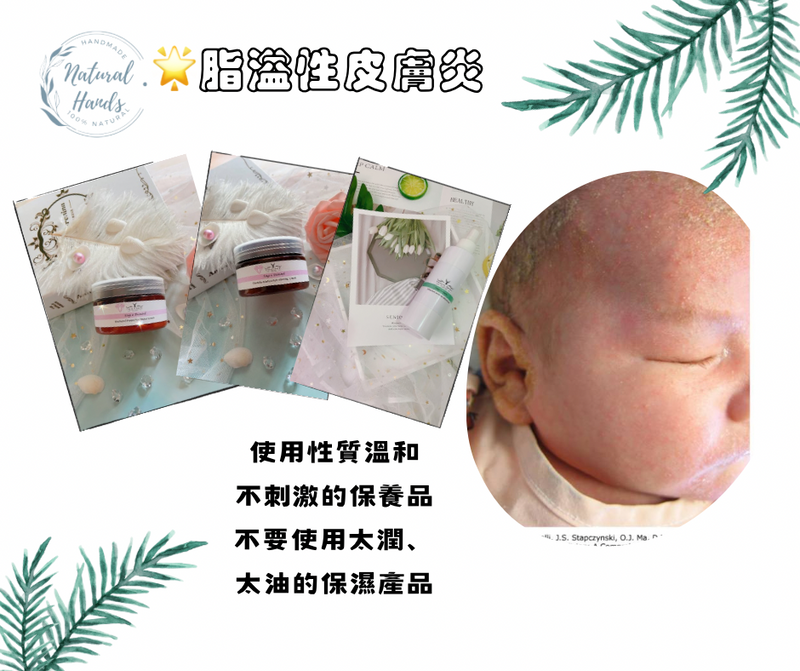 脂溢性皮膚炎套裝